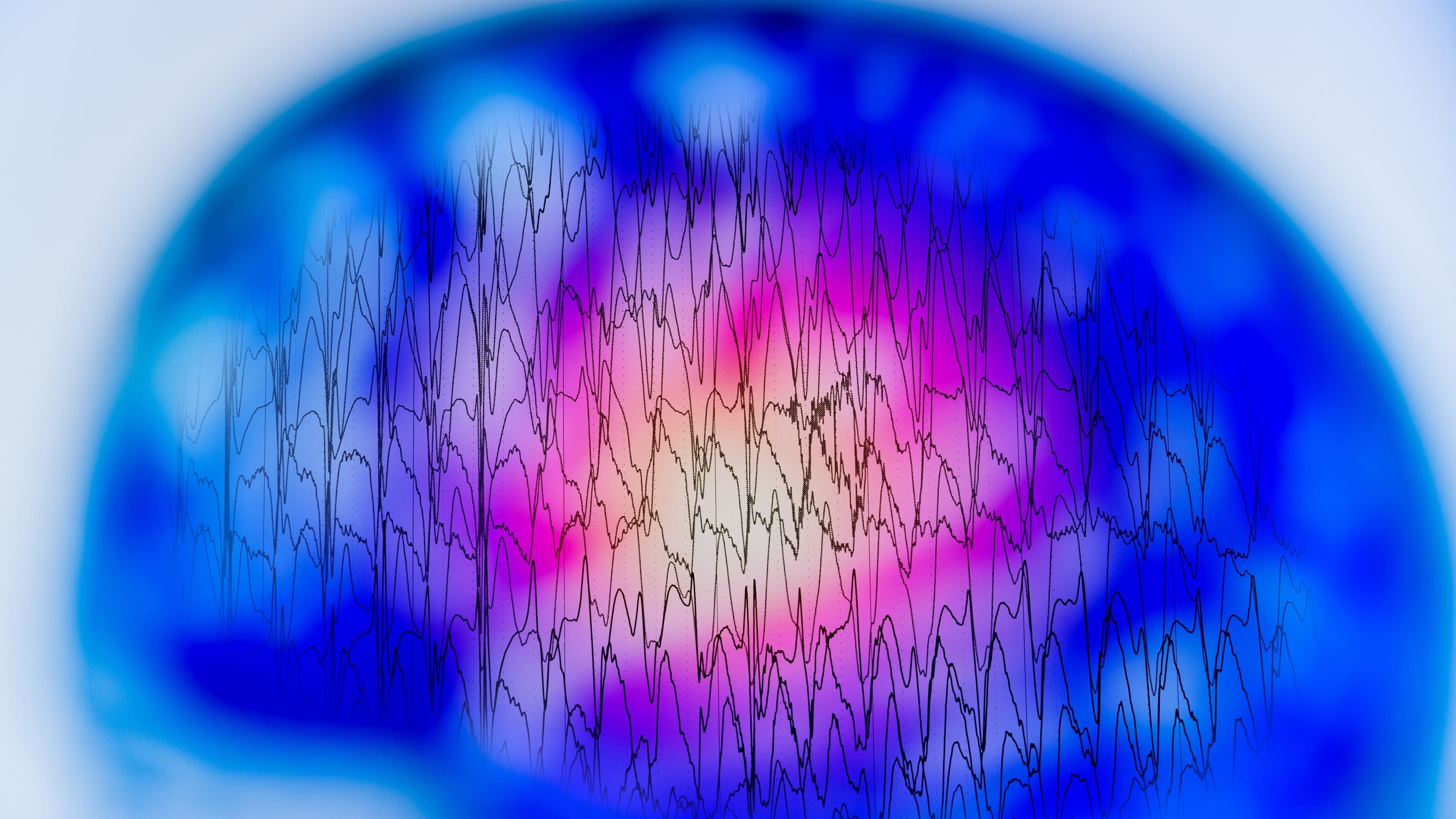 Electroencephalogram, EEG, which can be used to detect seizures associated with epilepsy