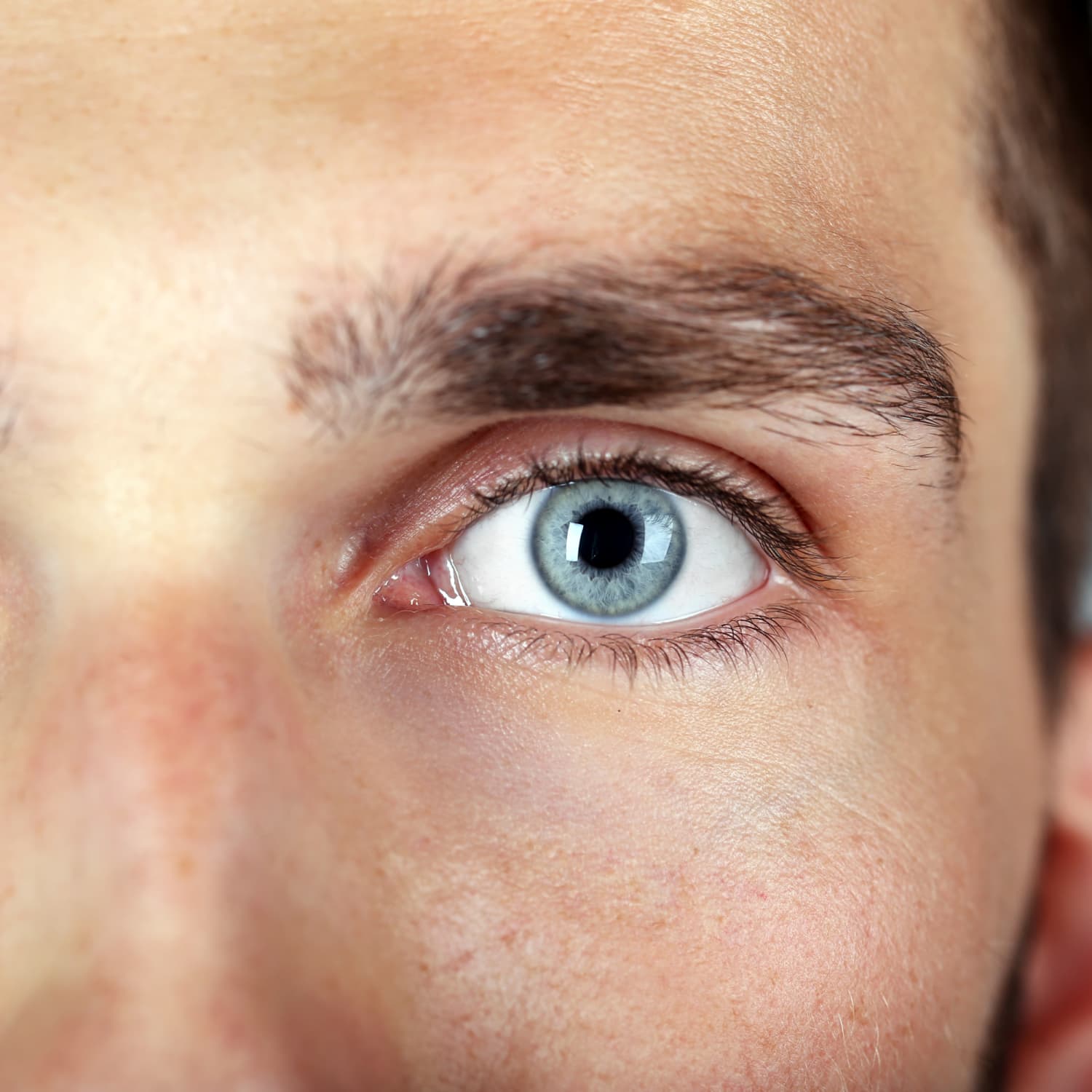 Yellow Eyes: Common Causes and When to See a Doctor