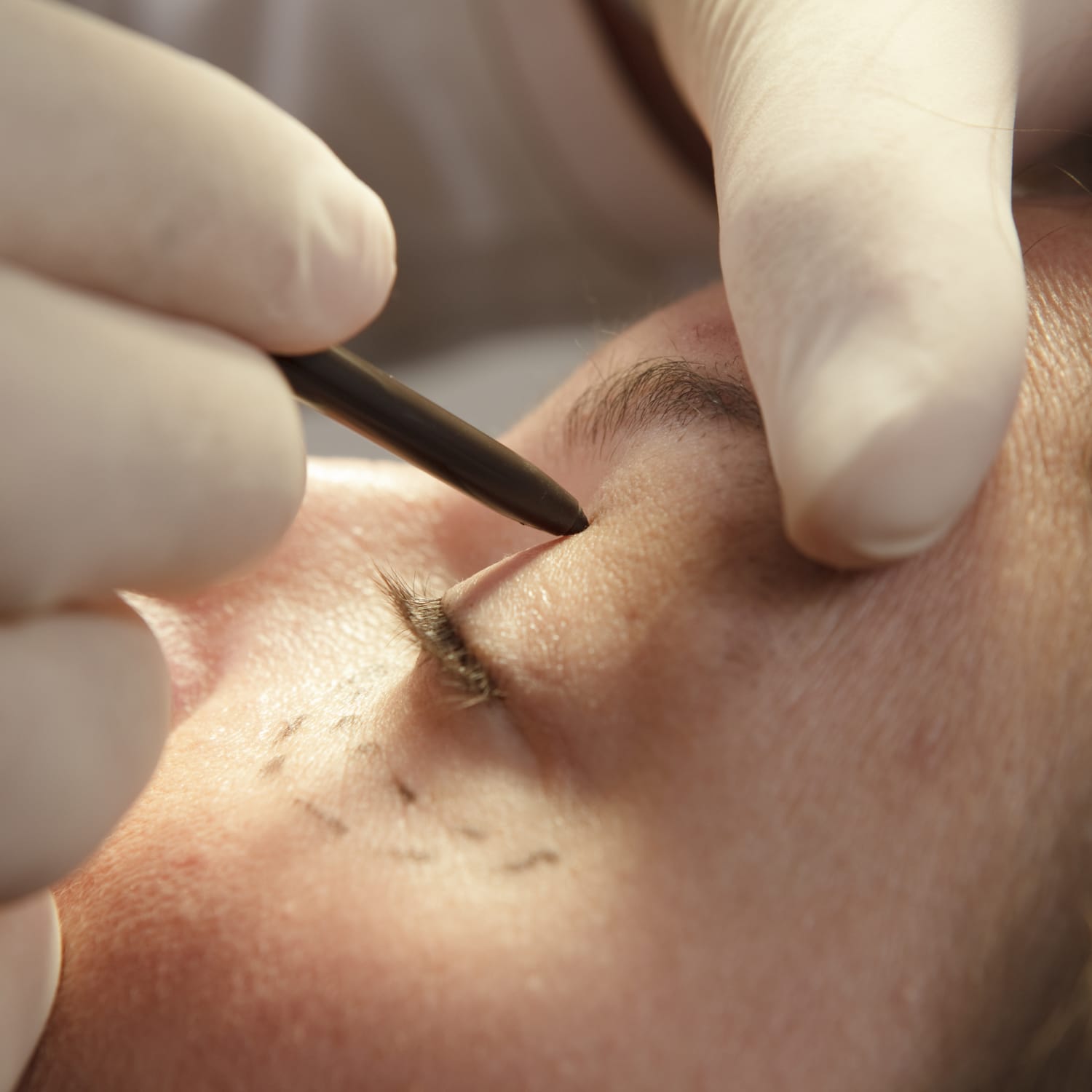Facial Plastic Surgery Austin