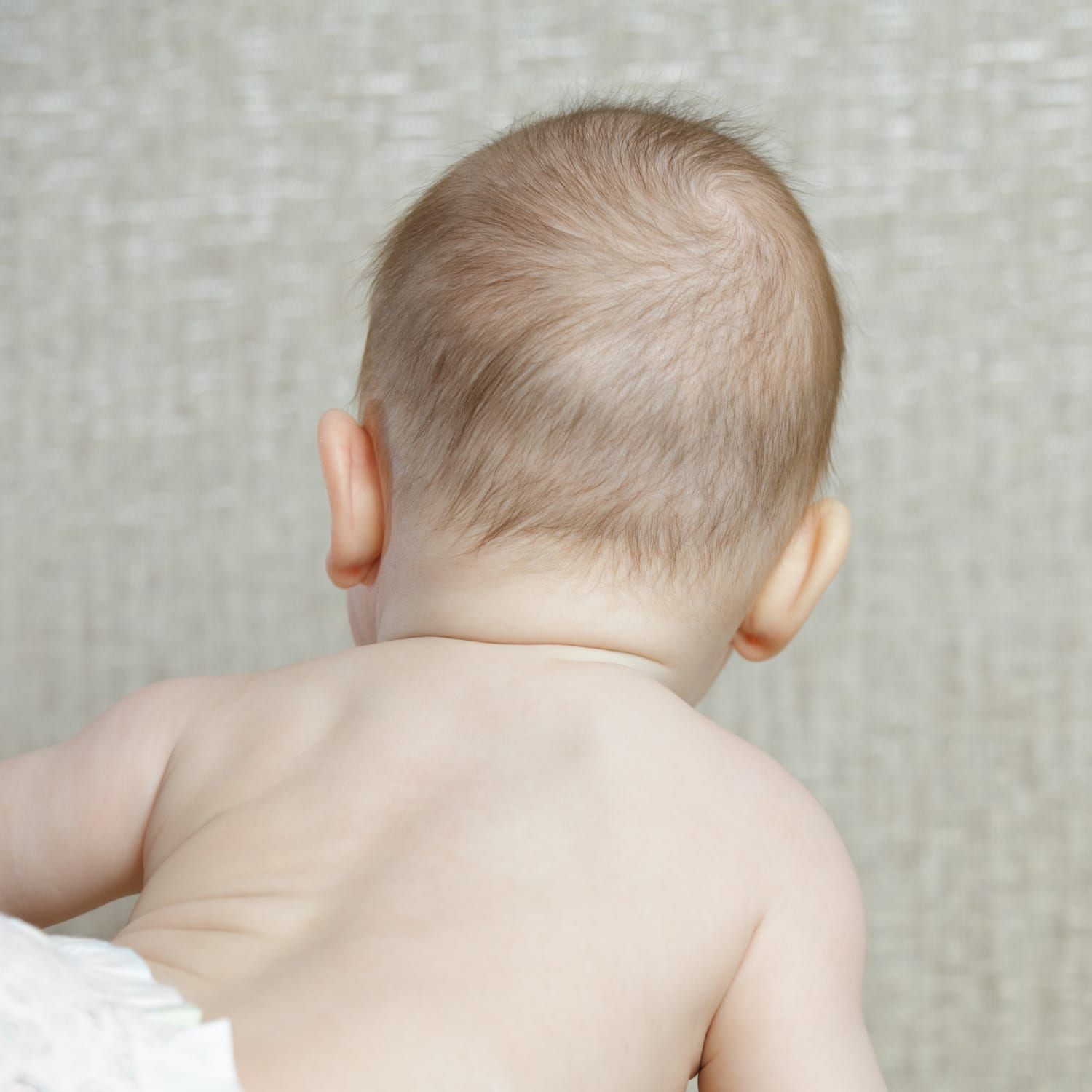 Flat patch on back of baby's head new arrivals