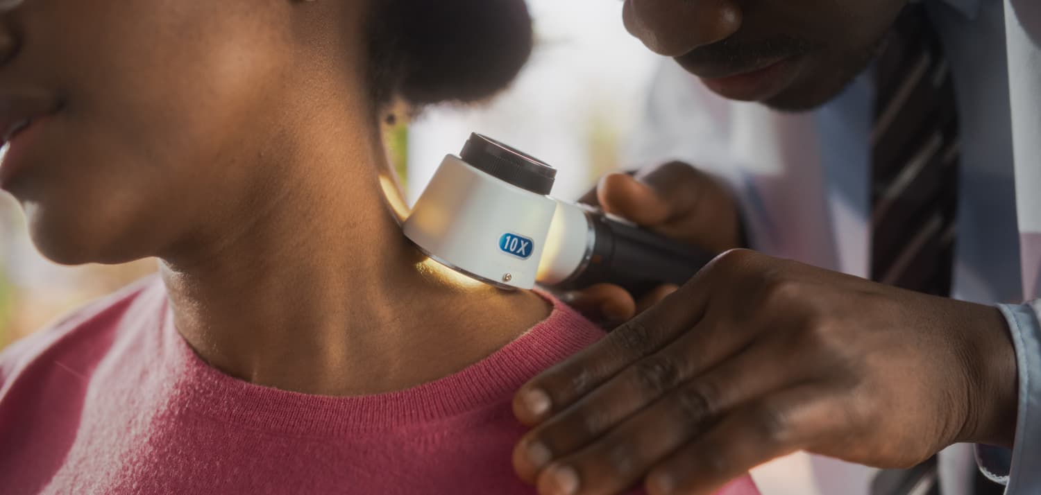 Doctor Examines Patient's Skin with Dermatoscope