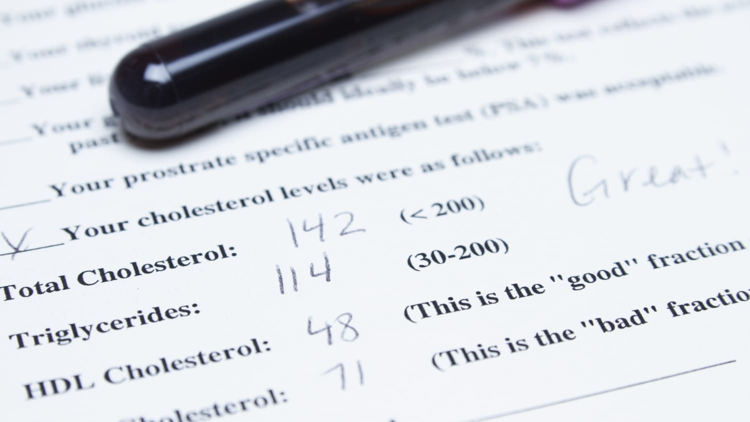 Cholesterol test result