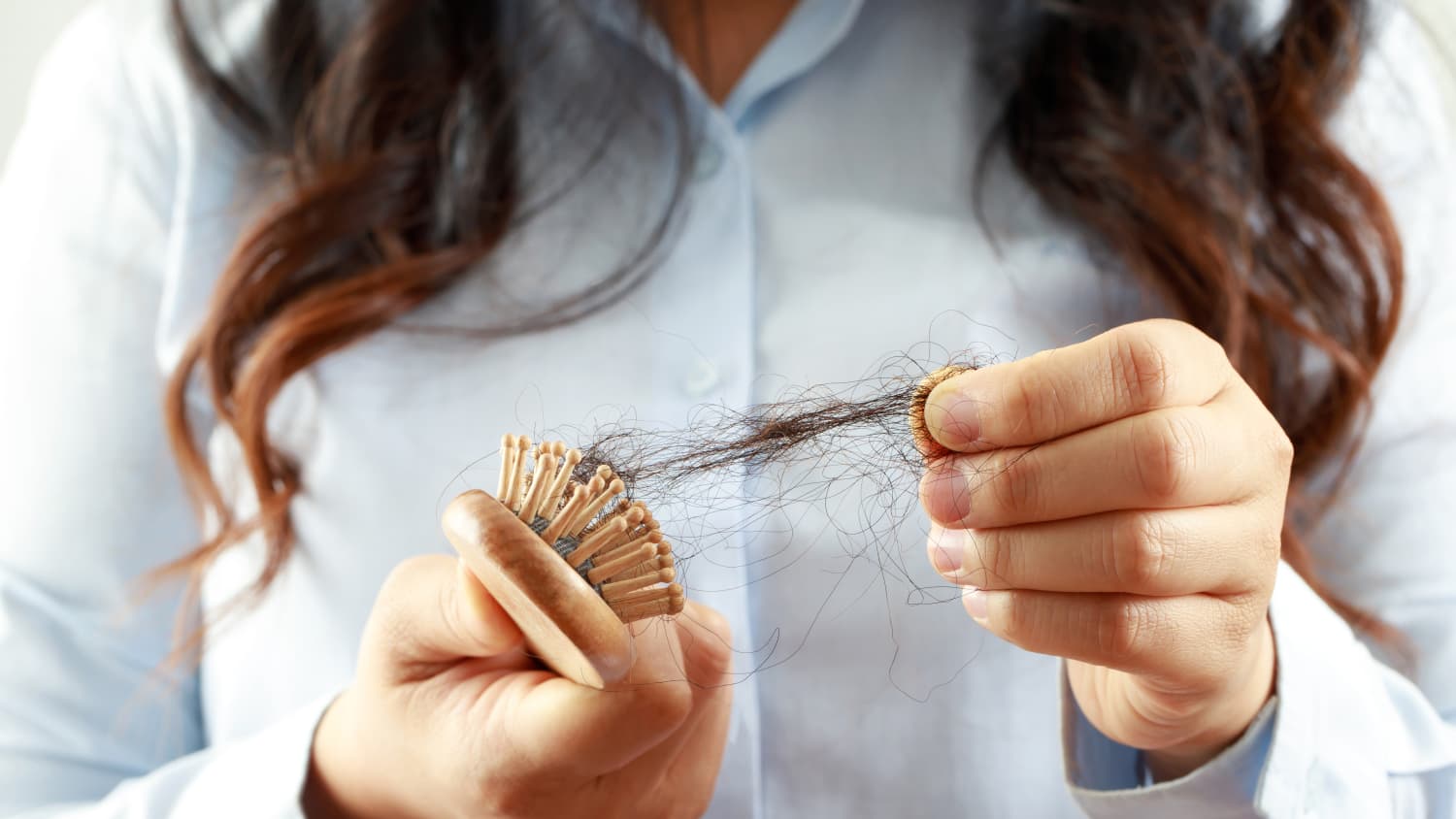 woman holding brush with hair on it, representing hair loss from alopecia areata