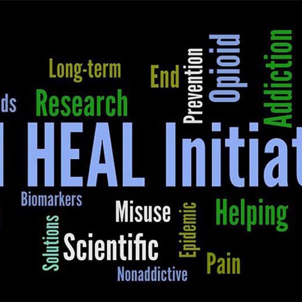 NIH Awards HEAL Grant to Study Novel Ways to Treat Pain