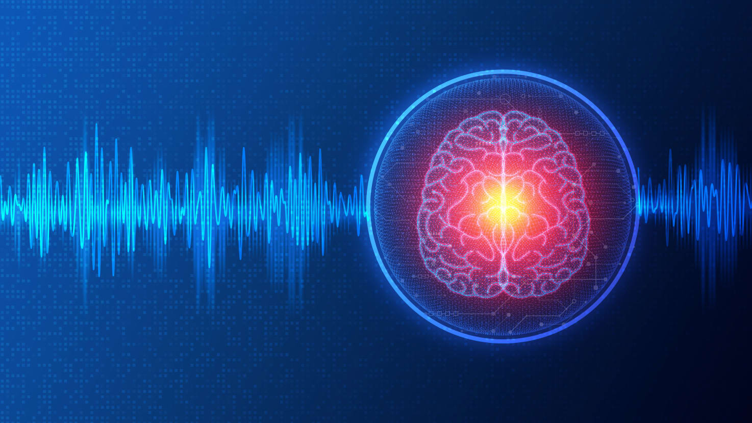 illustration of Electroconvulsive therapy (ECT)