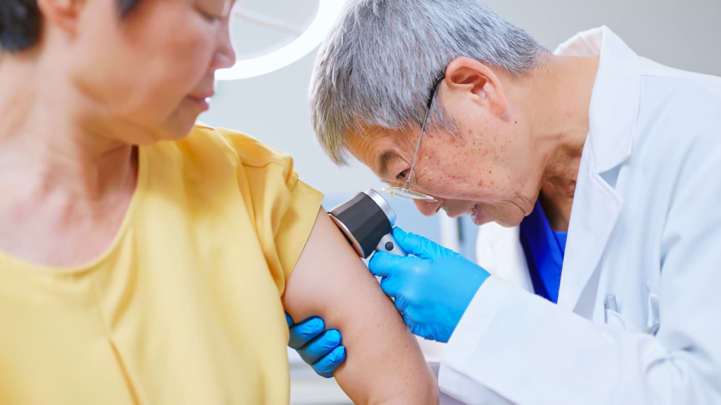 Doctor Examine Patient's Skin with Dermatoscope