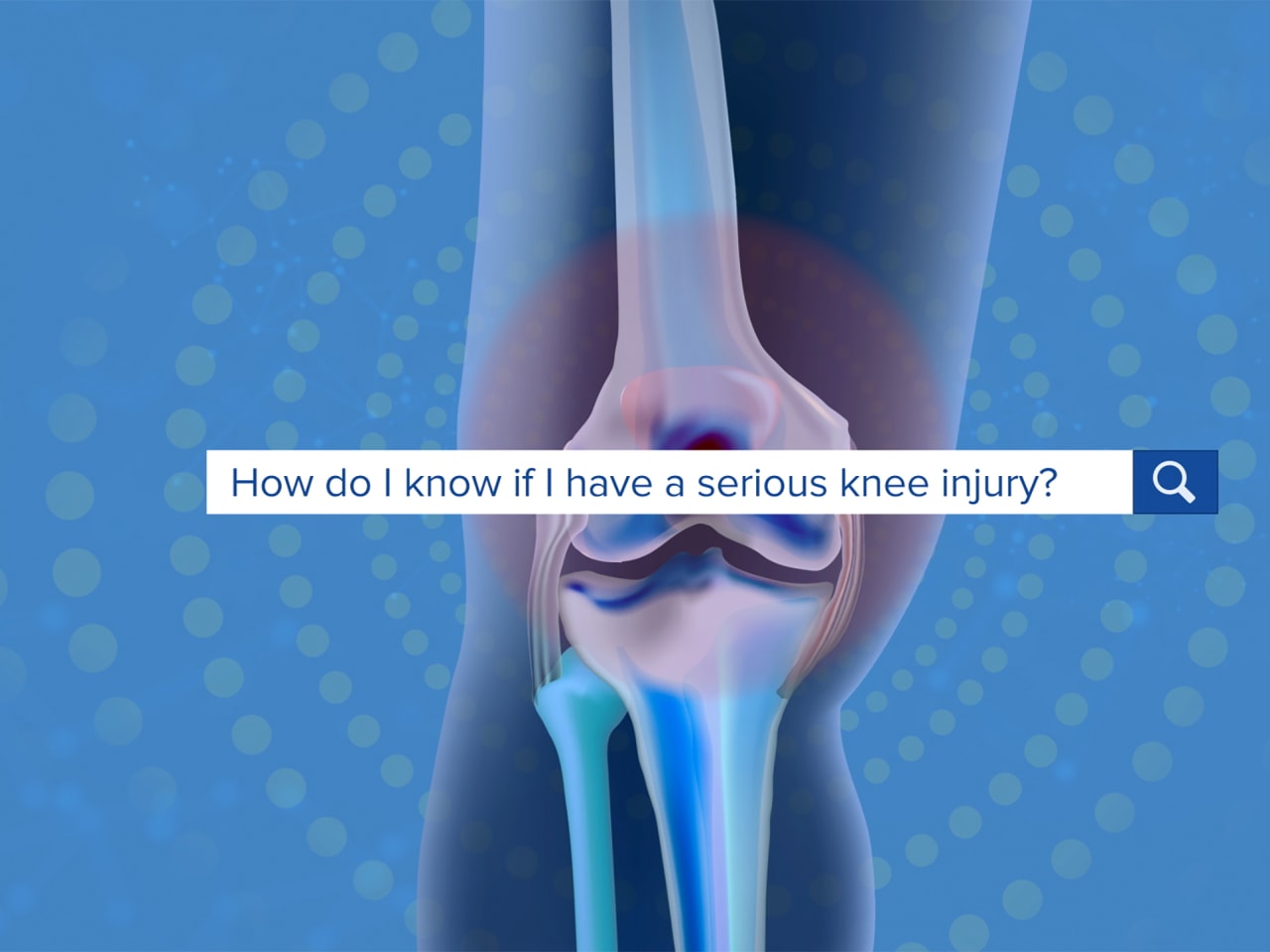 How To Tell If a Knee Injury Is Serious Yale Medicine Explains News Yale Medicine