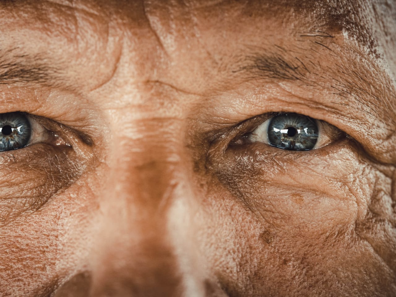Eye tumor sale