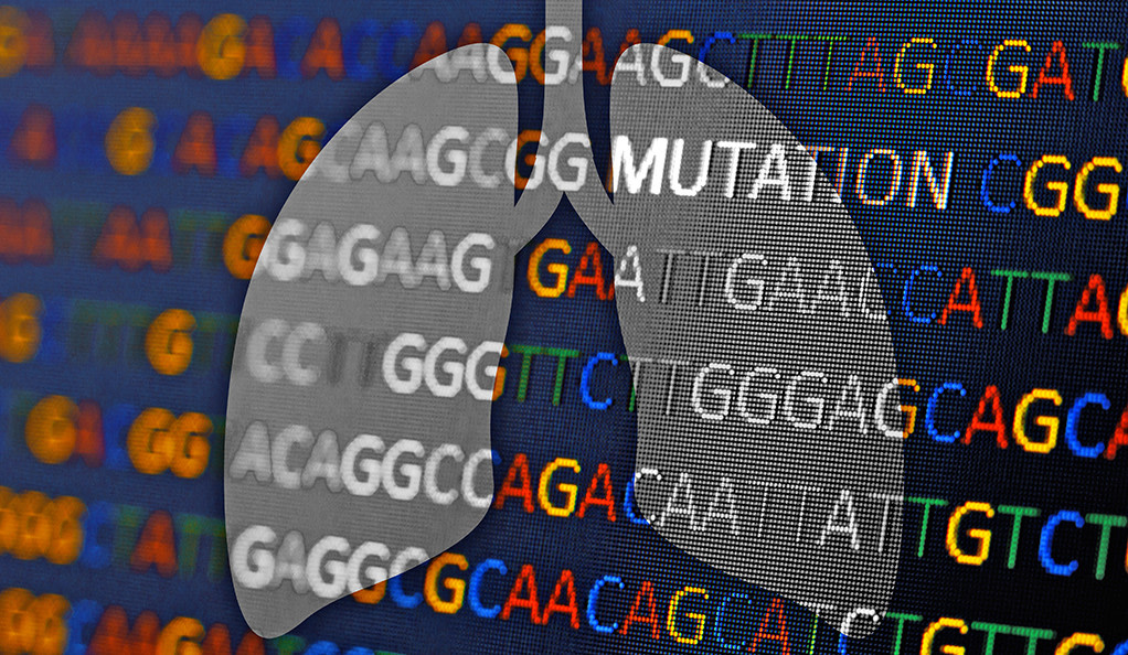 broad-genetic-testing-for-advanced-lung-cancer-may-not-improve-survival