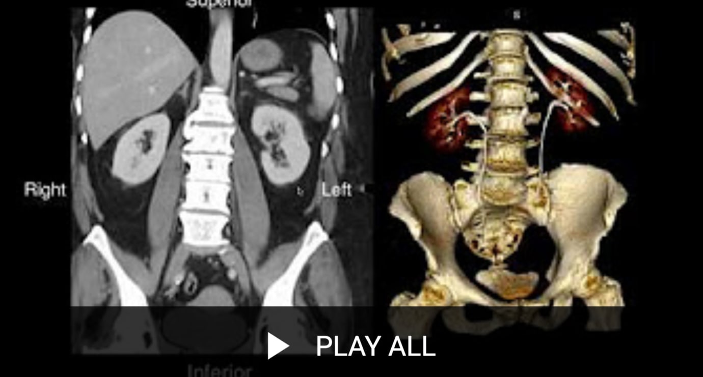 Body Imaging Division