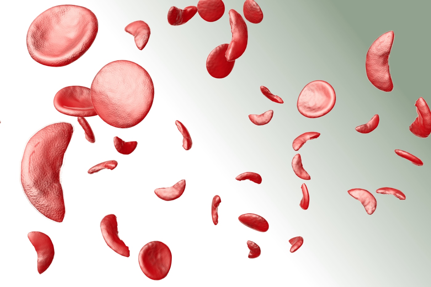 Is sickle cell a cancer