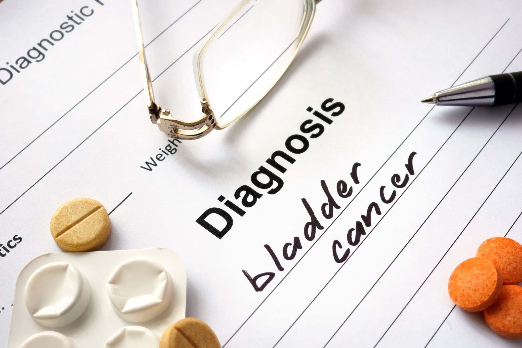 Backed by Yale Cancer Center Research, FDA Approves New Drug for Advanced Bladder Cancer