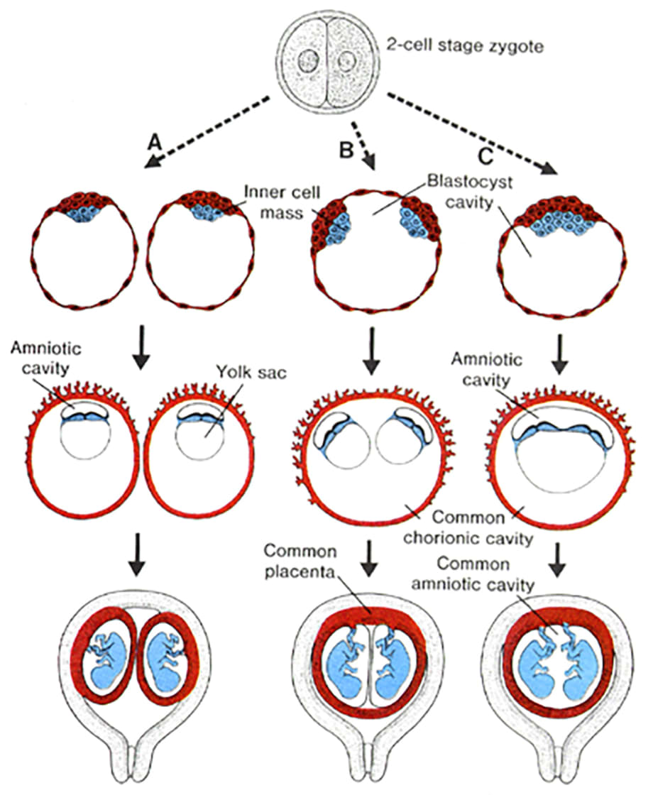 Twins | Reproductive and Placental Research Unit, image size:920x1120