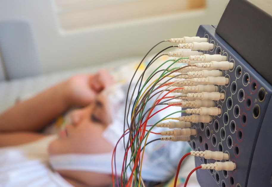 yale-surgeons-develop-new-techniques-in-epilepsy-surgery