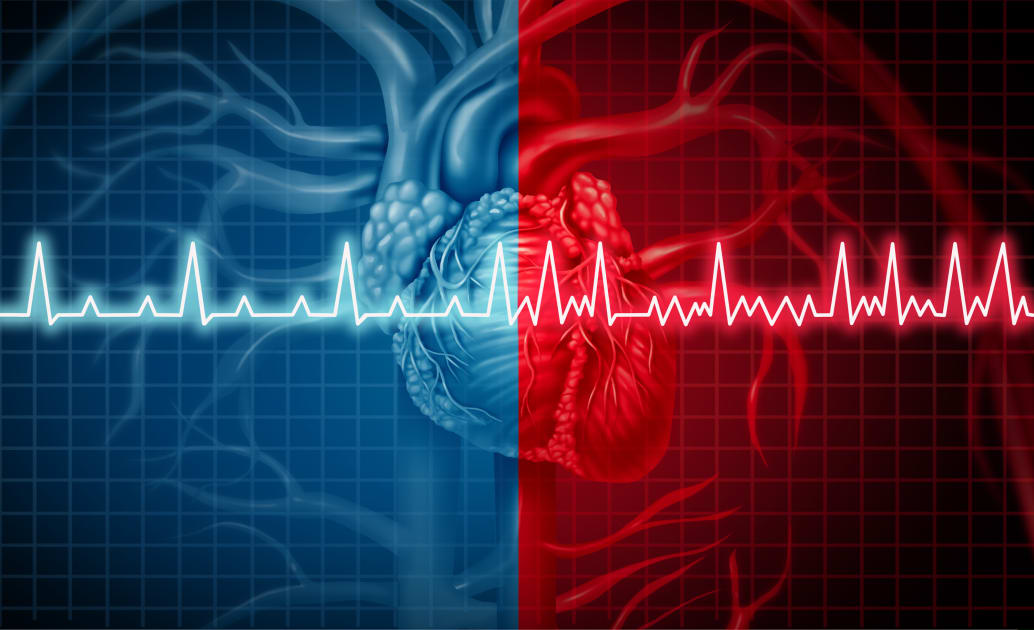 Atrial Fibrillation Diminishes Women’s Quality of Life and Presents Treatment Complications More Than for Men