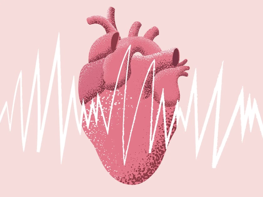 New AI Tool Identifies Risk of Future Heart Failure < Yale School of Medicine