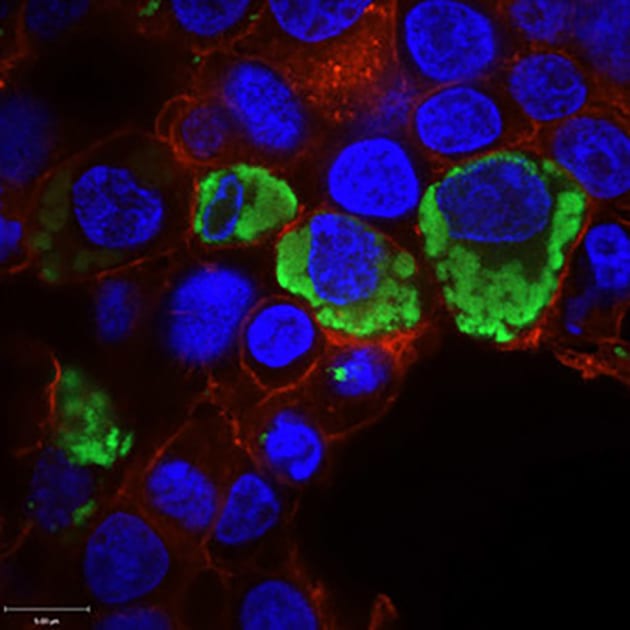 Yale scientists study genes misidentified as ‘non-protein coding’