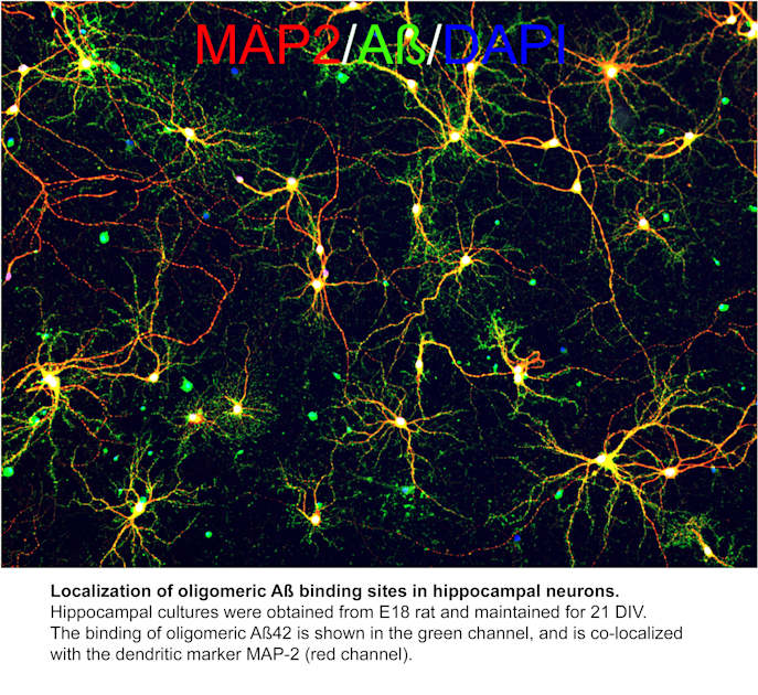 Microscopic visualization of oligomeric amyloid beta protein structures in Alzheimer's disease research