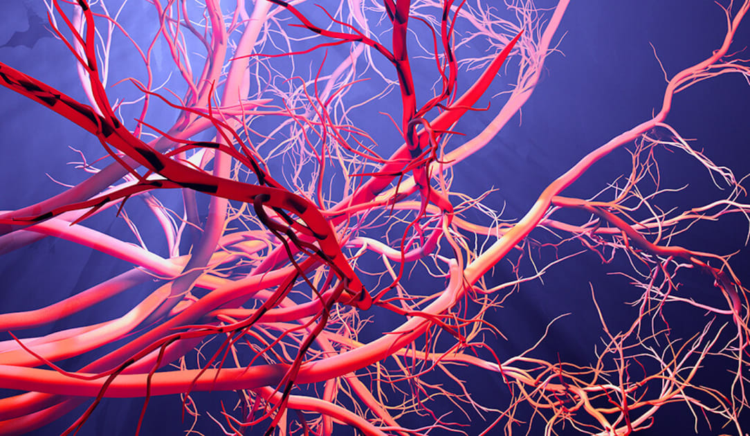 Yale IDs Test to Detect Blood Vessel Injury, Predict Survival in COVID19