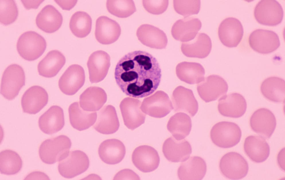 Neutrophils in the Immune System Help Build Healthy Skin < Yale School of Medicine