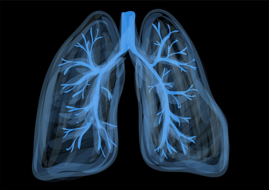 Latest Research on Lung Disease