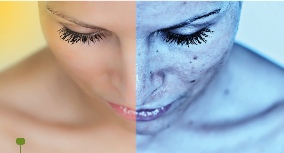 Sun Damage Occurs Even after Sunset