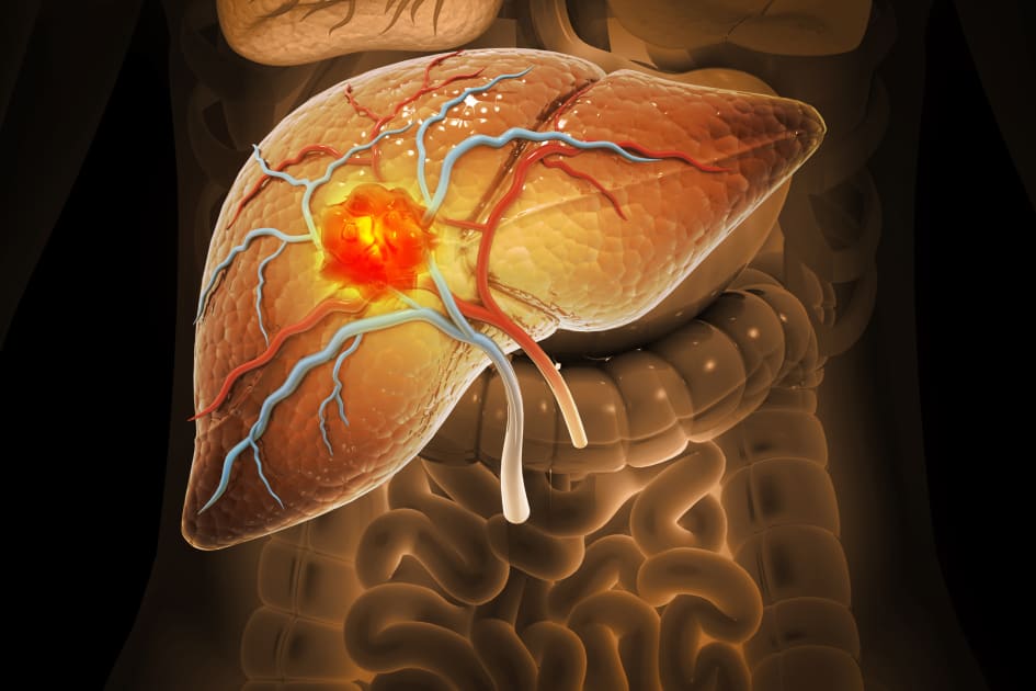 A New Tool for Improved Detection < Yale School of Medicine