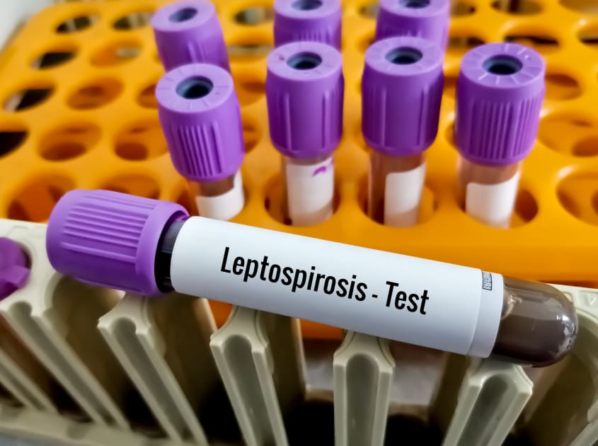 Yale Medicine Team Develops Vaccine for Deadly Leptospirosis Bacteria