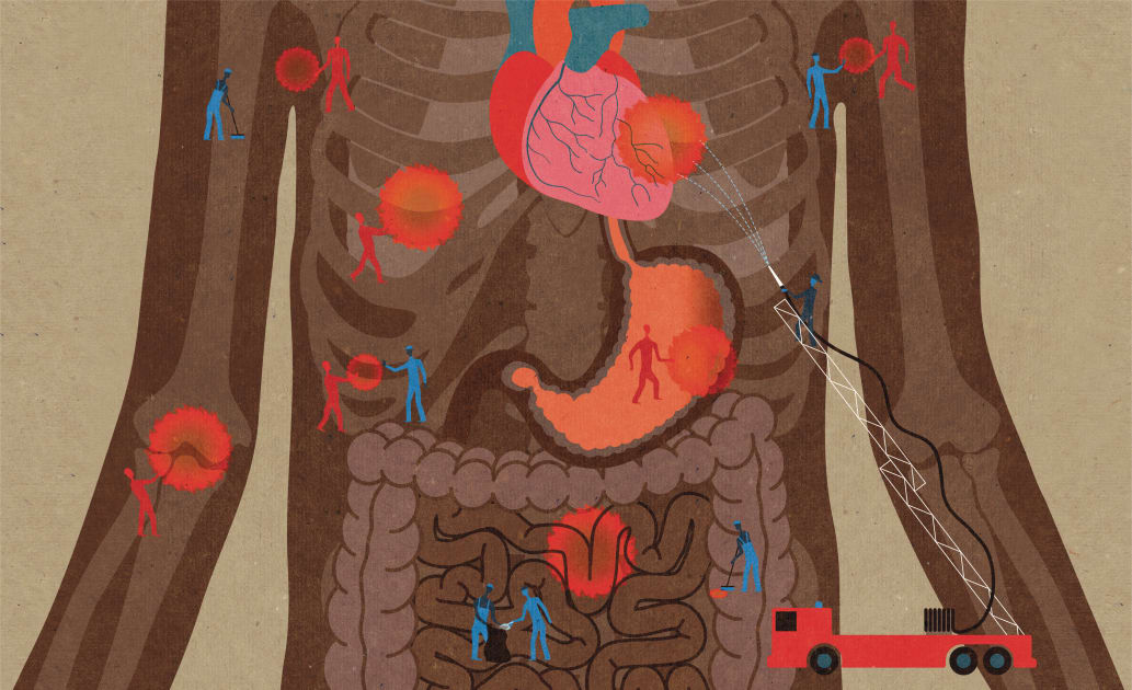 A Double-Edged Sword for the Immune System < Yale School of Medicine