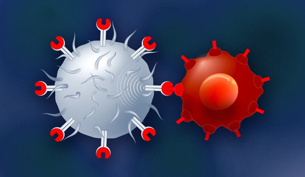 CAR T-Cell Therapy: Pathology Is Key to This Revolutionary Cancer Treatment