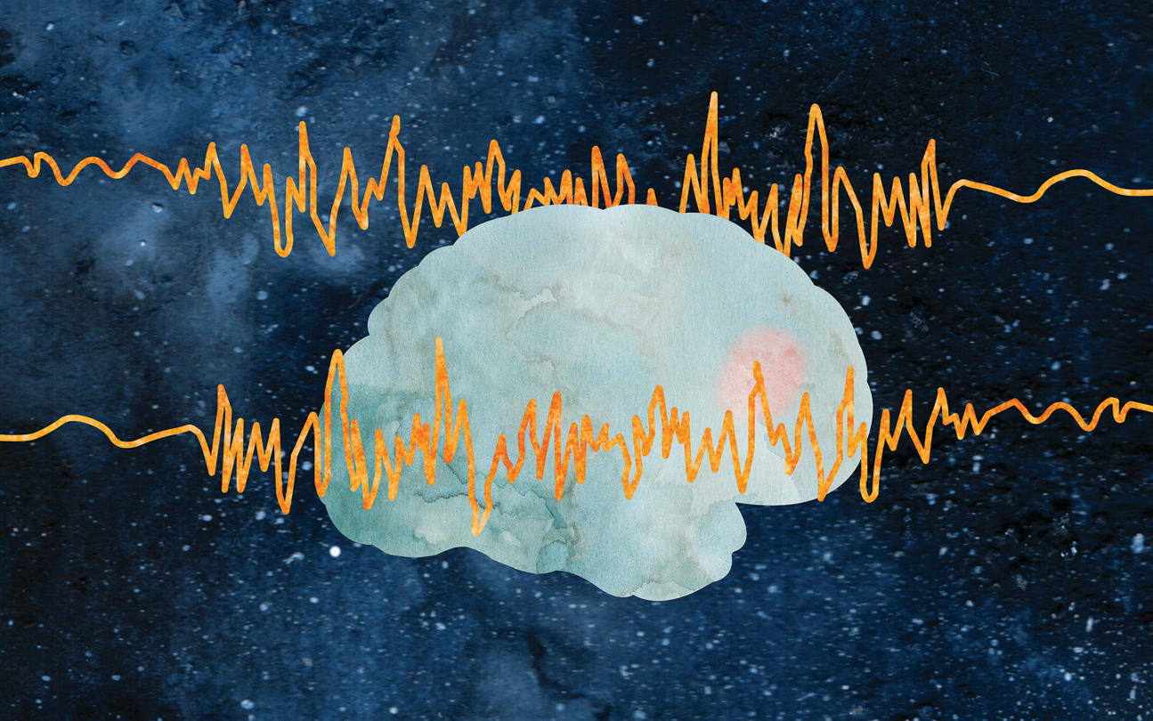 Epilepsy or Not? PNES Mistaken for More Common Seizure Disorder > News > Yale Medicine