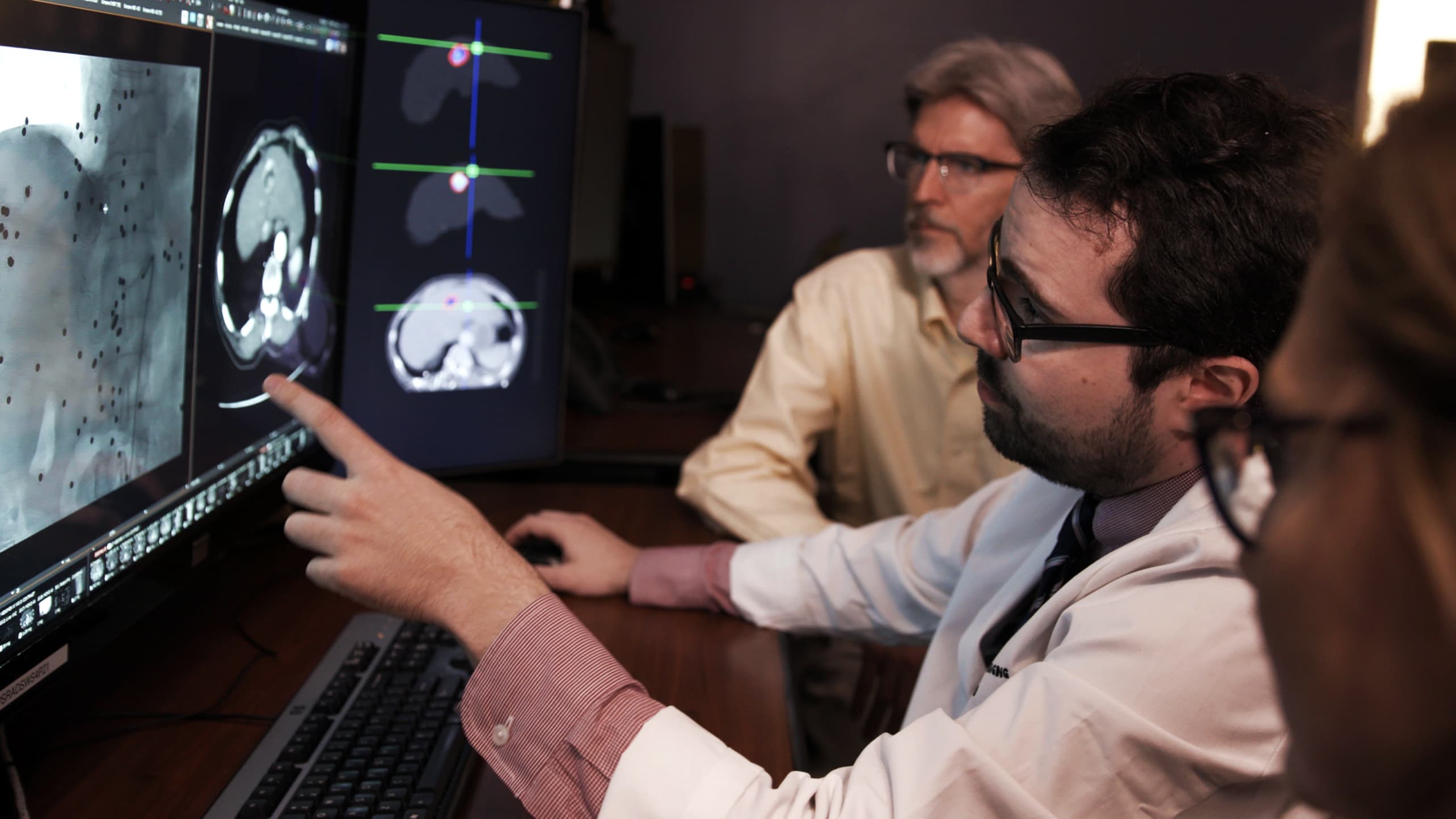 Doctors and researchers look over liver cancer imaging.