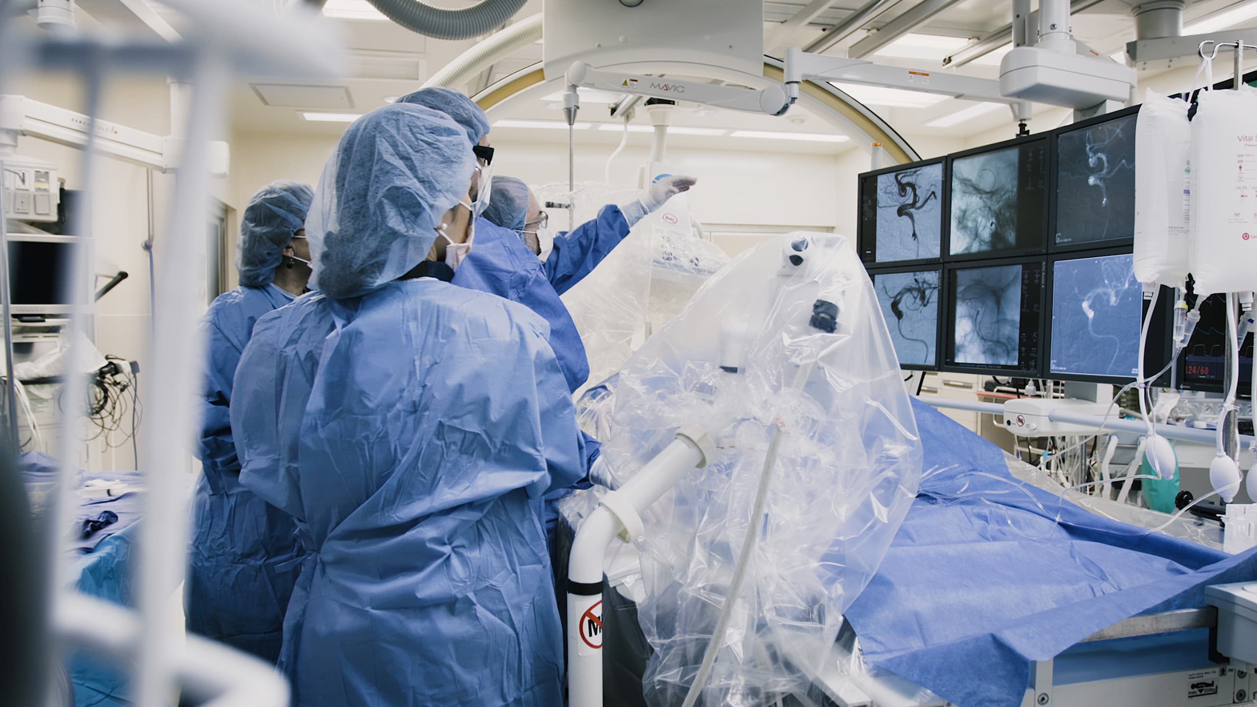 Neurosurgeons perform endovacular surgery to treat a brain aneurysm.