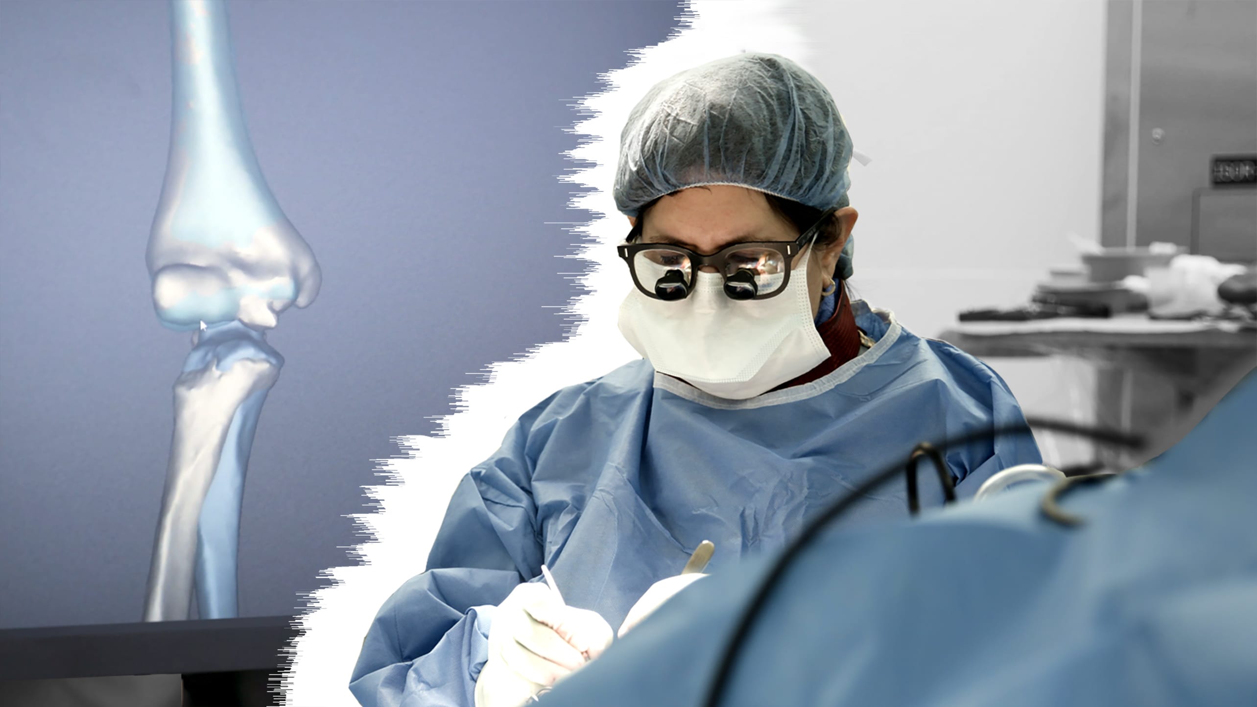 A doctor operates on a patient in front of a 3D rendering of the patient's bone.