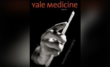 Unbreakable” bones prompt a hunt for genes < Yale School of Medicine