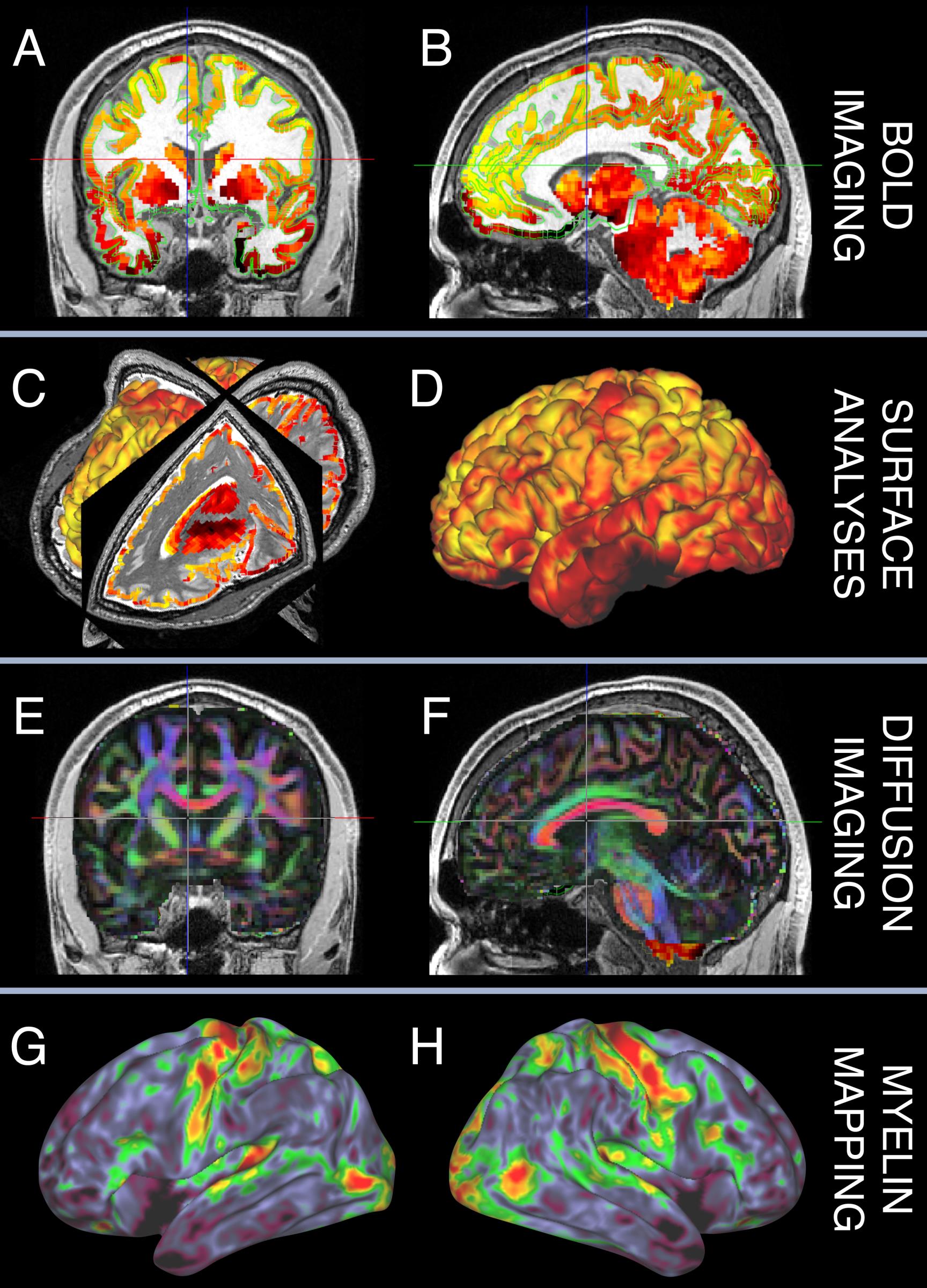 Neuroimaging Acquisition Resources