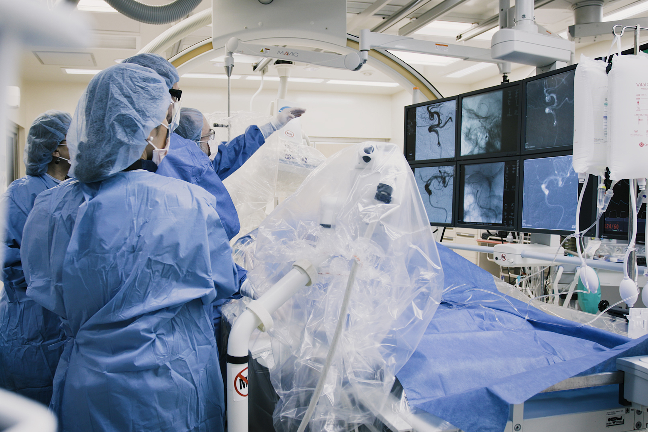 A New Way to Treat Brain Aneurysms > News > Yale Medicine