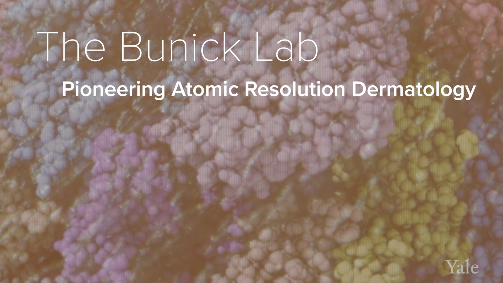 Skin Diseases, Structural Biology & Crystallography - The Bunick Lab at ...