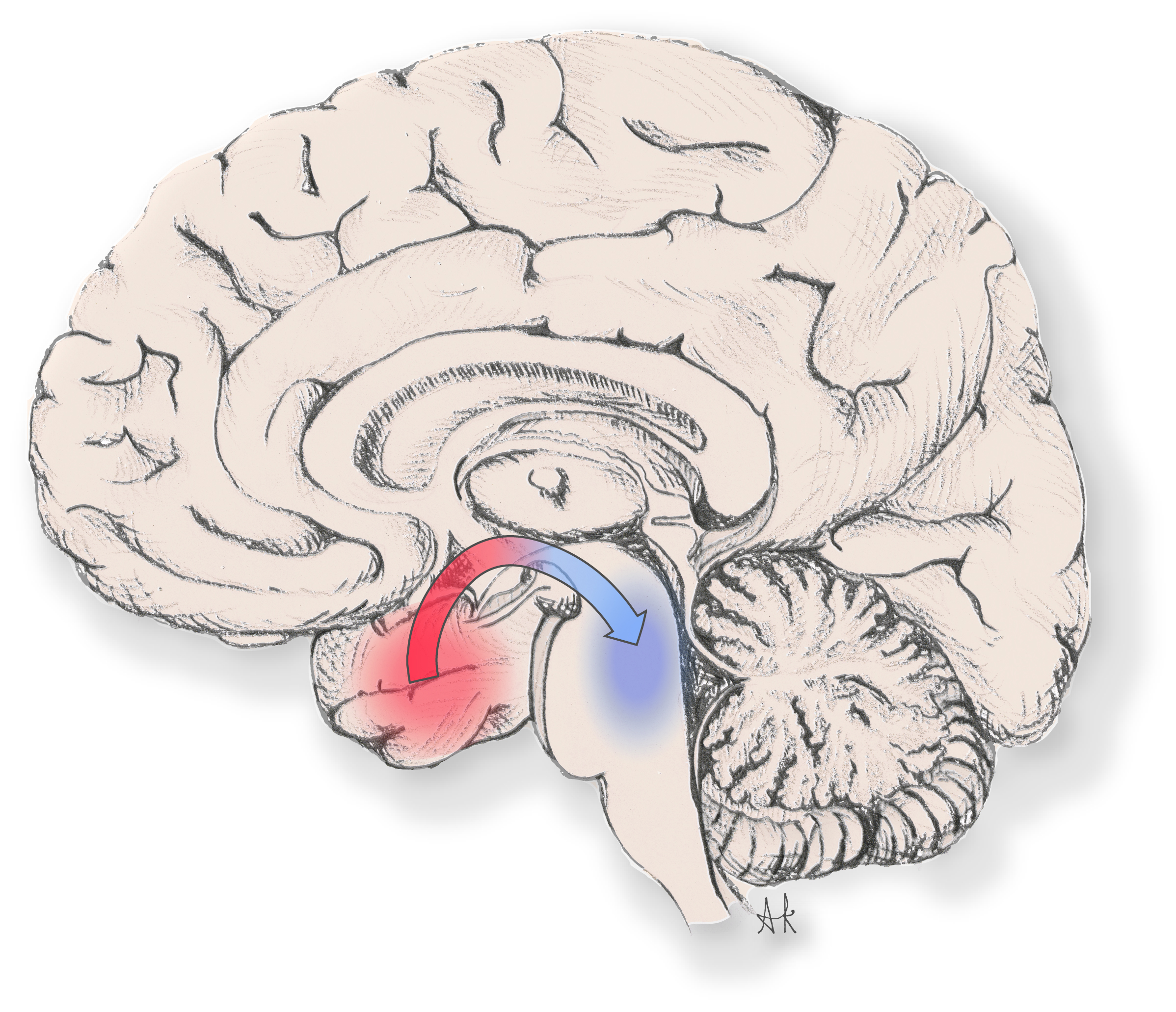 Research in the news: Seizures knock out brain arousal centers