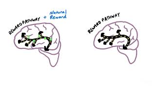 Dopamine Addiction: Is It Real?