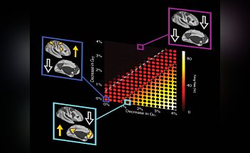 Research team uses pharmacological neuroimaging and computational