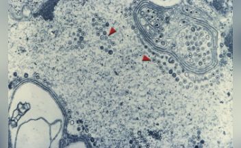 Outsmarting Herpes Researchers Use The Body S Natural Defenses To